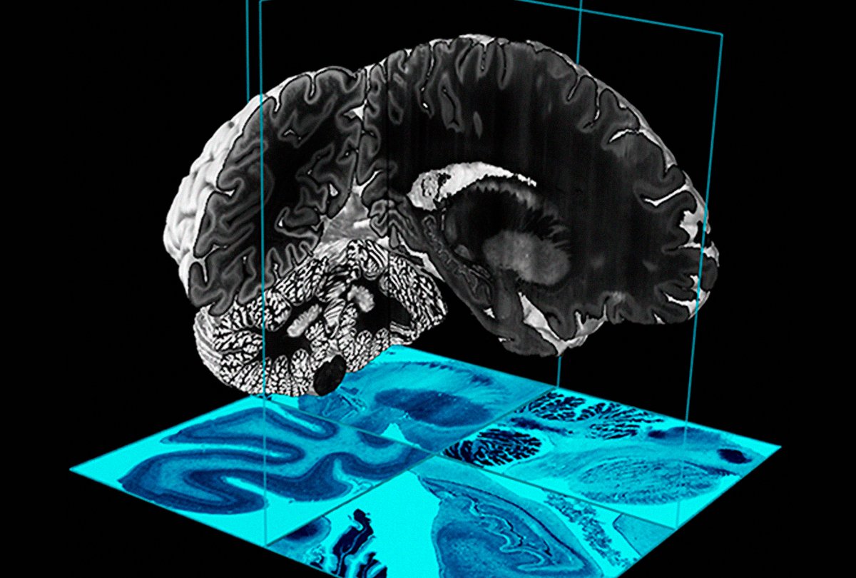 Large brain. Моделирование мозга. Модель мозга объемная. Проекция мозга. Компьютерная модель мозга.